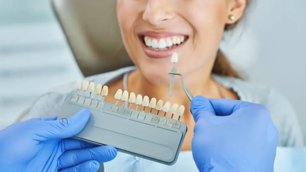 Guía de tonos durante una valoración de blanqueamiento dental